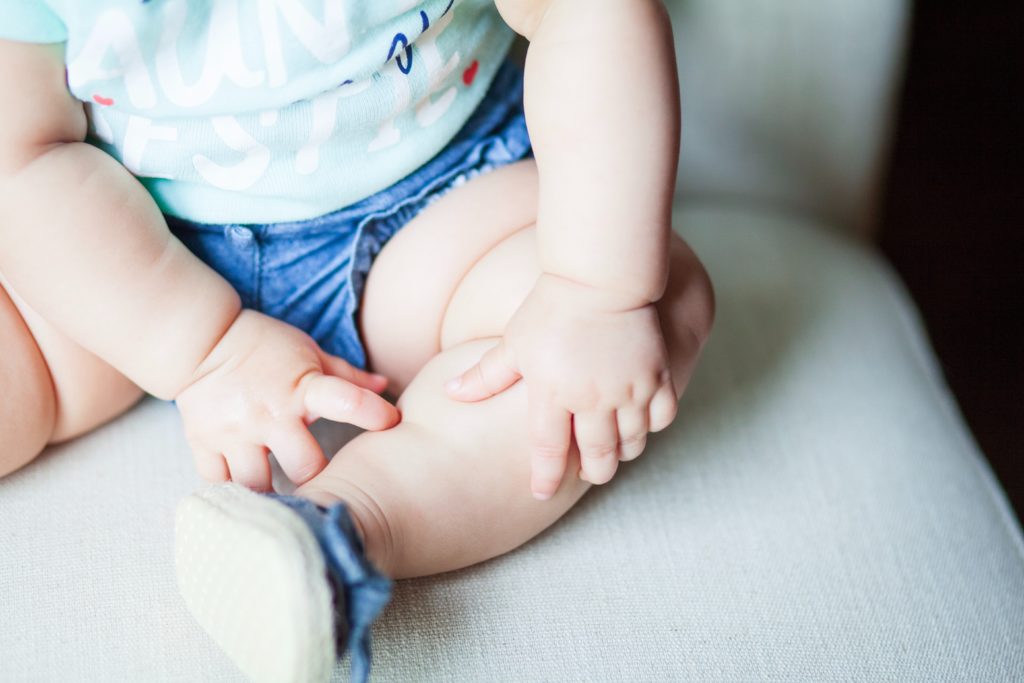 yeast infection in baby a photo of leg folds on a newborn